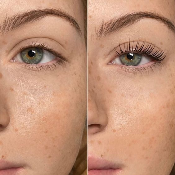 Serum Pousse rapide cils™
